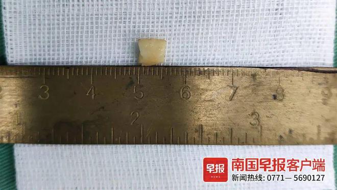 k8凯发天生赢家一触即发宝宝感冒宝宝感冒的症状桂林一小孩反复咳嗽当感冒治了一个月